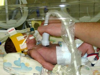 В Украине закупили смертельно опасные инкубаторы для малышей фото