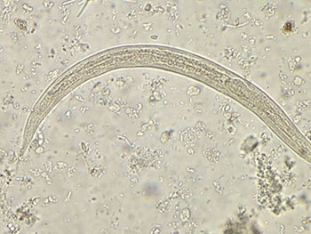 Зафиксирован первый случай заражения человека раком фото
