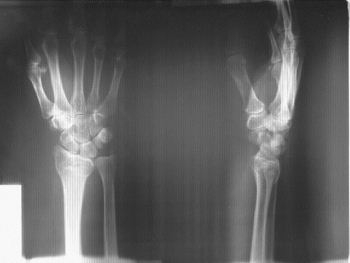 На запорожском предприятии произошел несчастный случай фото