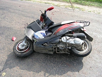 Пассажир мопеда после ДТП в больнице фото