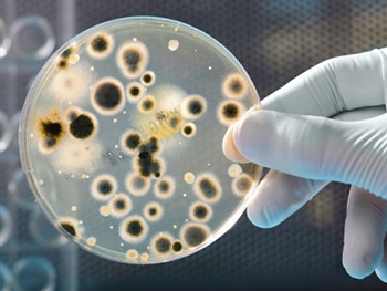 Какие предметы грязнее унитаза? фото