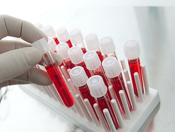 Дату смерти человека будут определять по анализу крови фото