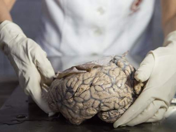 Медики впервые зафиксировали работу человеческого мозга после смерти фото