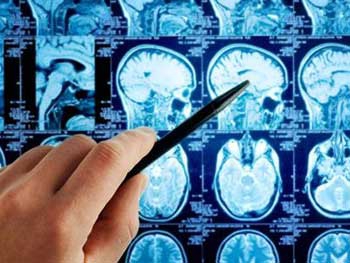 Советы врачей о мерах профилактики онкологии фото