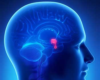 Лечение кисты гипофиза в Израиле фото