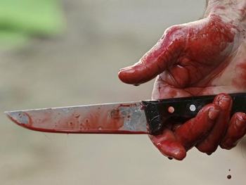 В запорожском дворе обнаружили труп в луже крови фото