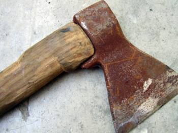 Сосед отрубил топором 6-летнему мальчику пальцы фото