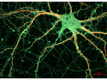 Ученые обнаружили в человеческом мозгу GPS-систему фото