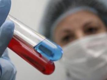 В Одесской области заболели корью 367 человек, двое умерли фото