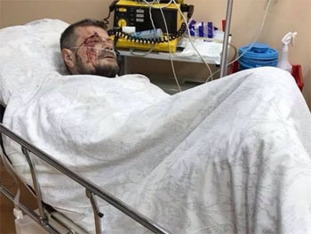 Состояние Мосийчука тяжелое, - врач фото