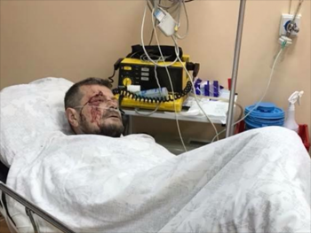 Мосийчук заявил, что покушение на него заказали в Москве фото