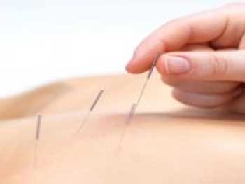 Фармакопунктура при остеохондрозе фото