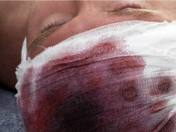 Полиция проверяет, было ли ночное нападение на мужчину фото