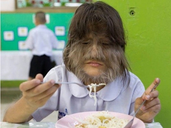 Самая волосатая в мире девушка вышла замуж и побрилась фото