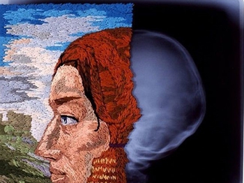 Художник создает необычные картины, используя рентгеновские снимки и вышивку. ФОТО фото