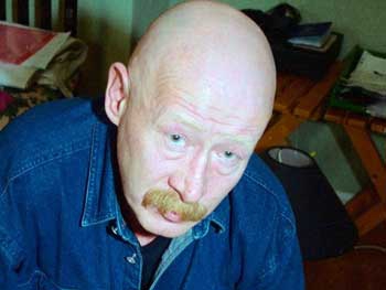 Двойной удар: российского актера поразили рак и анорексия  фото