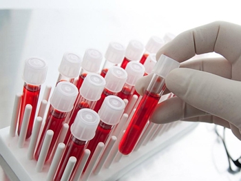 Почему кровь надо сдавать на пустой желудок? фото