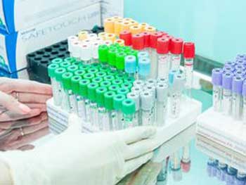 Украинцам при подаче заявления в ЗАГС будут предлагать добровольно обследоваться на TORCH-инфекции фото