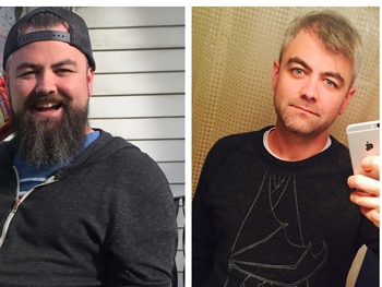 До и после: как меняется внешность человека, который перестает пить  фото
