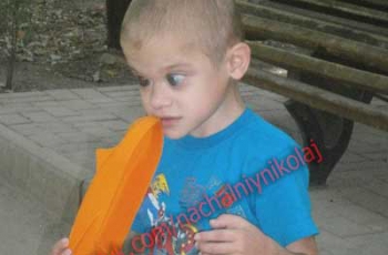 Тяжелобольному ребенку с жуткой судьбой нужна помощь фото
