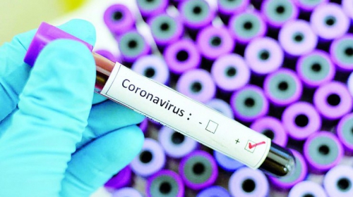 В Украину привезут тесты, которые за 15 минут определят у человека наличие коронавируса  фото