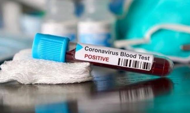 Количество заболевших COVID-19 в Веселовском сельсовете и Запорожском медуниверситете увеличилось фото