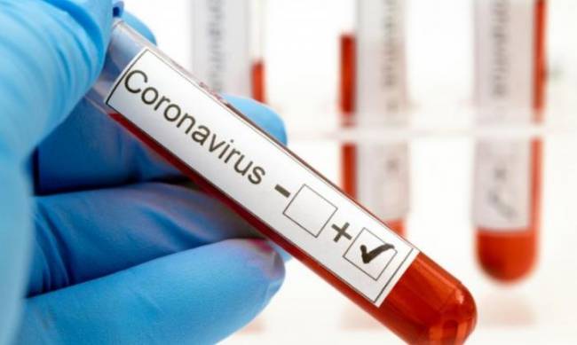 В Запорожской области выявлено 80 новых случаев заражения коронавирусом    фото