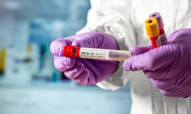 Еще у 106 жителей Запорожской области выявили коронавирус  фото