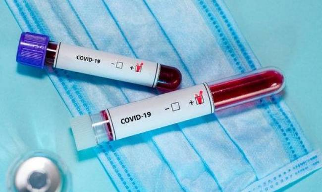 В Мелитополе коронавирусом заболели еще 6 человек  фото
