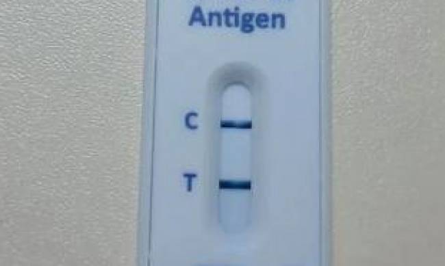 Врач показал новый экспрес-тест на антиген COVID-19, который появится в Украине фото
