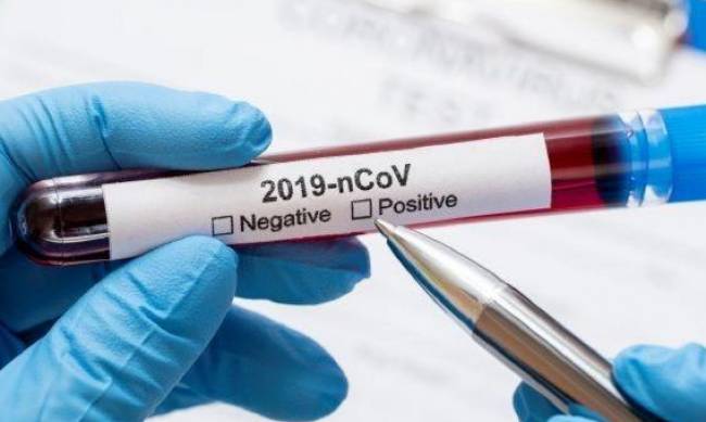 Во Франции начинают первые кампании массового тестирования на коронавирус фото