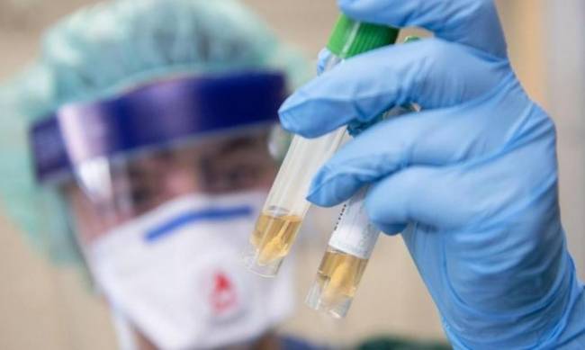 Больше сотни подтвержденных случаев коронавируса за сутки - горздрав фото