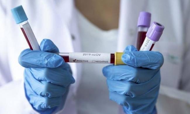 Новый вид коронавируса из Британии обнаружили в трех других странах фото