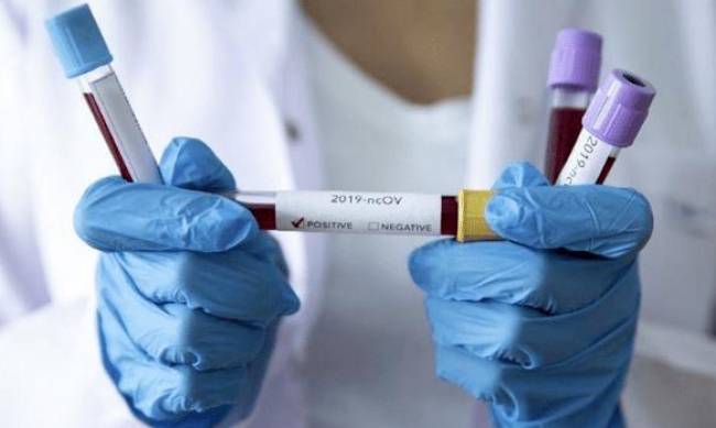 Коронавирус в Мелитополе: как изменилась статистика после выходных фото