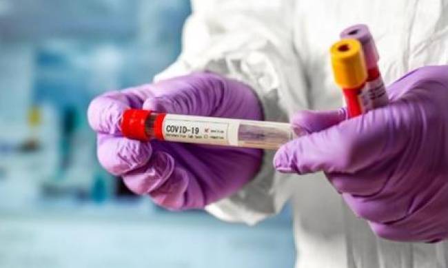 В Мелитополе 31 заболевший и одна смерть от COVID-19 фото