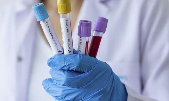 В Мелитополе новая смерть от COVID-19: статистика заболевания после выходных  фото