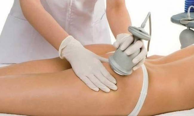 Ультразвукова кавітація в медицині: сучасні методи та перспективи використання фото