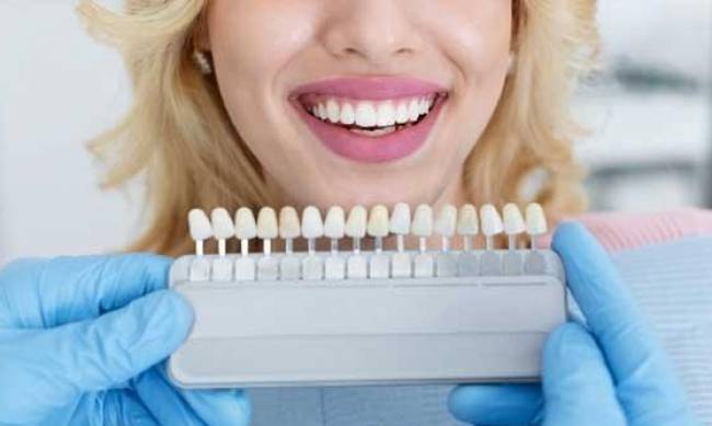 Відбілювання зубів вдома: які засоби існують та як вони діють фото