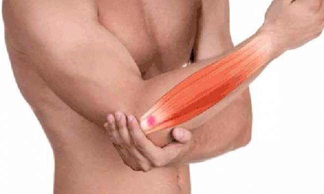 Ліктьовий суглоб. Сучасні методи відновлення та профілактики фото